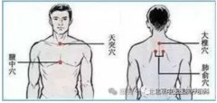 
咳喘、关节痛、总怕冷？三伏贴的关键知识都在